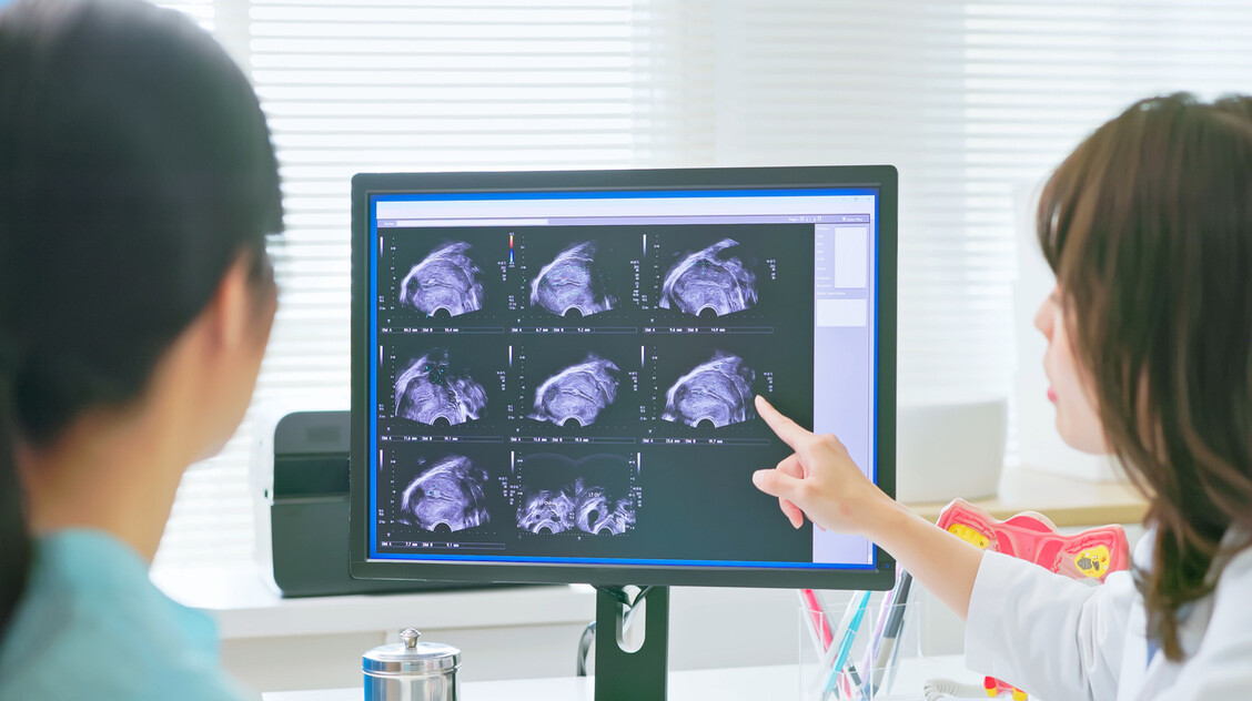 Remény endometriózis-gyanúnál: egyszerűbb lesz diagnosztizálni a betegséget?