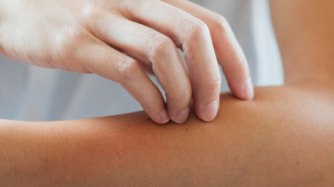 Bőrgomba: így állítható meg a terjedése – Mutatjuk, mikor kell bőrgyógyász
