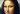 Felvethető, hogy a Mona Lisa című képen ábrázolt hölgy örökletes magas koleszterinszint betegségben szenvedett