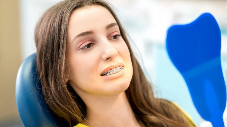 Mire kell figyelni fogszabályozás előtt?