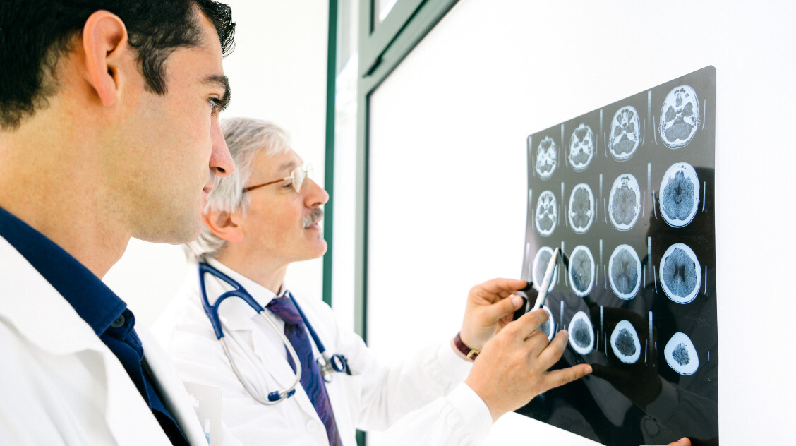 Stroke előtt: így lehet felismerni az átmeneti iszkémiás rohamot