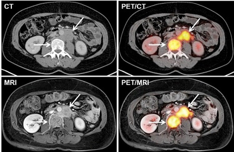 MRI, CT, PET-CT: nézze meg, mire számíthat a vizsgálatokon!