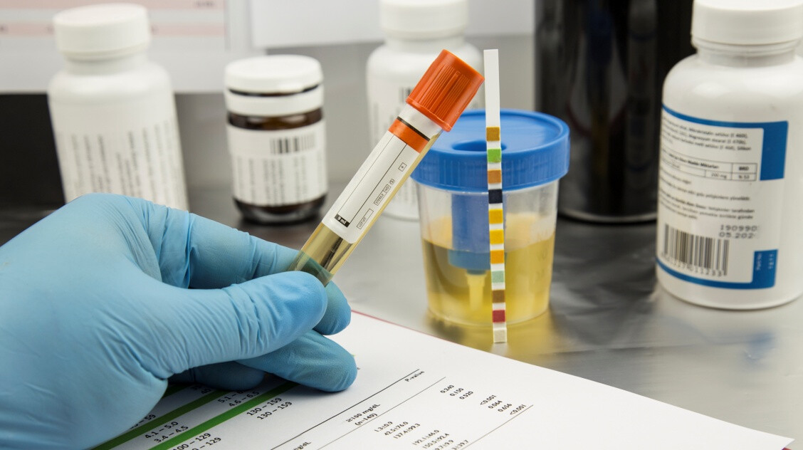 Vizeletvizsgálat: ilyenkor fontos elvégezni