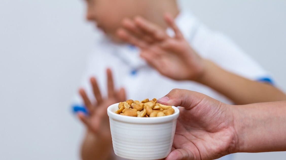 Életveszélyes mogyoróallergia: miből lehet észrevenni első alkalommal?