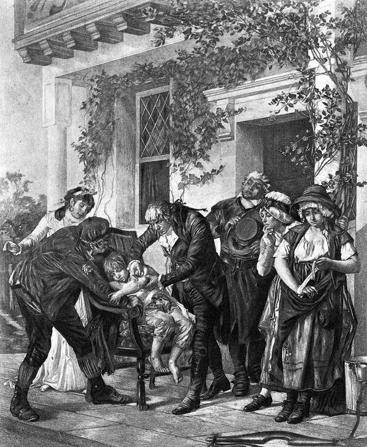 1894-es illusztráció Edward Jennerről, amint beadja az első fekete himlő elleni vakcinát